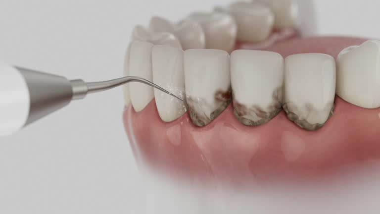 Reliable Dental Implants contractor in Kearns, UT by Smile Center Dentistry